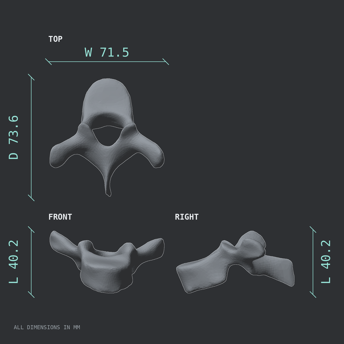 3D rendered dimensional drawing of the T3 thoracic vertebra, top, front, and side views.