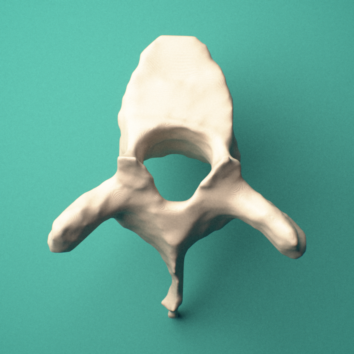 3D-printed T4 thoracic vertebra, superior view showing the vertebral body and vertebral foramen.