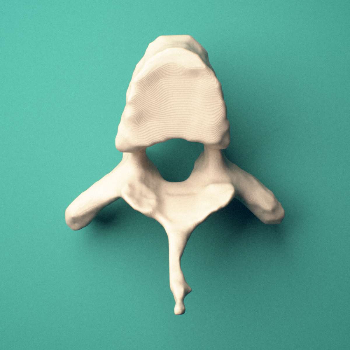 3D-printed T4 thoracic vertebra, superior oblique view showing the spinous process and superior costal facets.