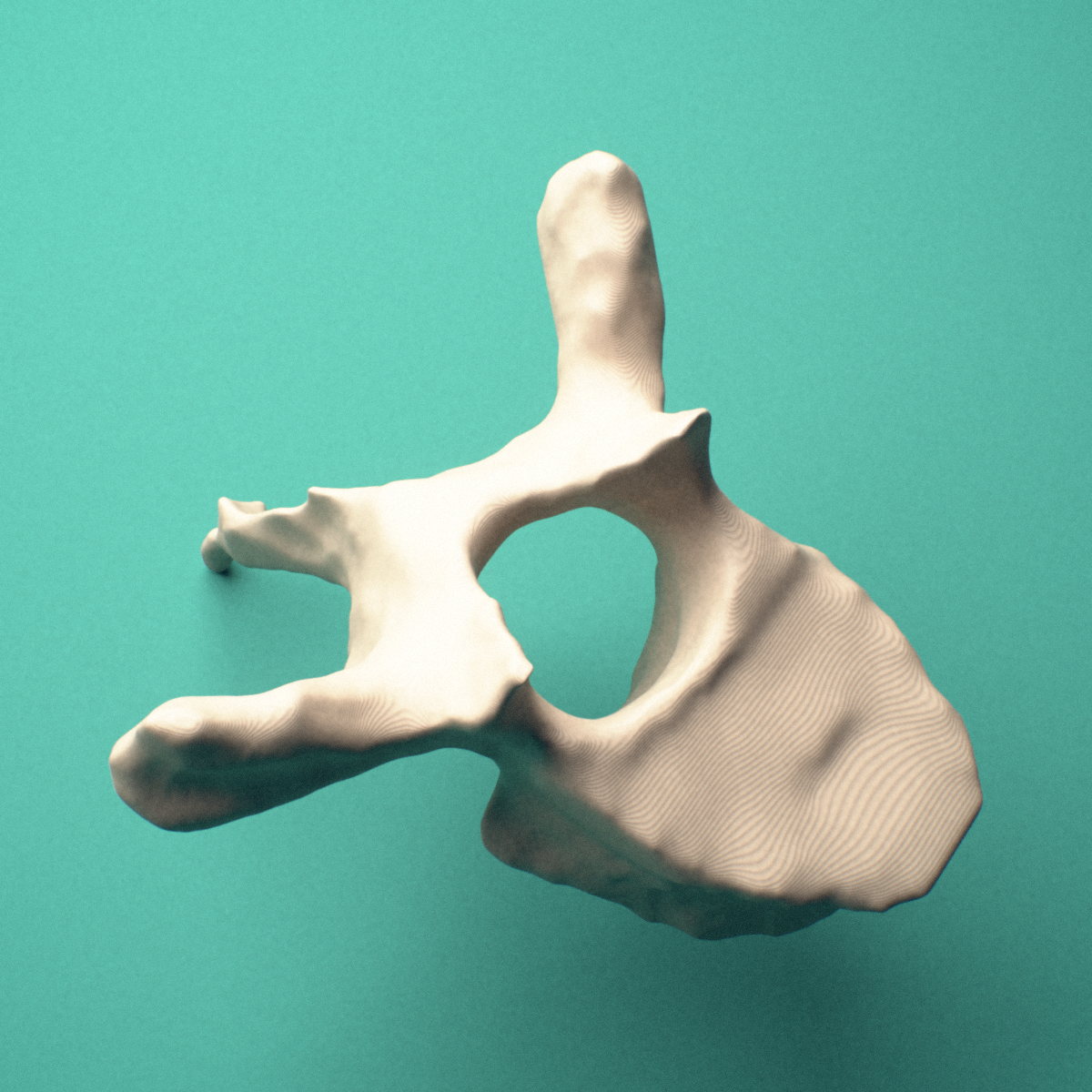 3D-printed T4 thoracic vertebra, posterior oblique view showing the laminae and spinous process.