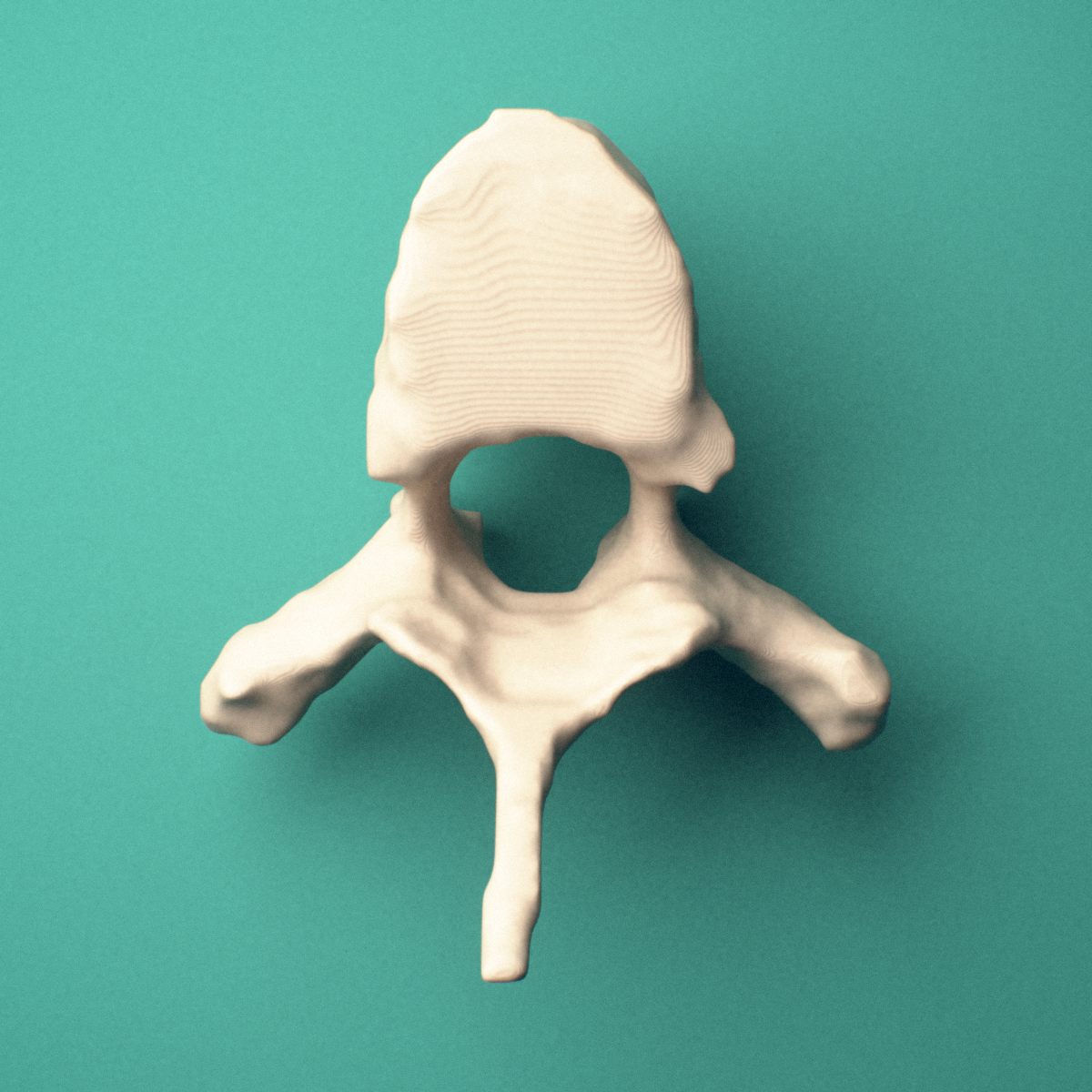 3D-printed T5 thoracic vertebra, superior oblique view showing the spinous process and superior costal facets.