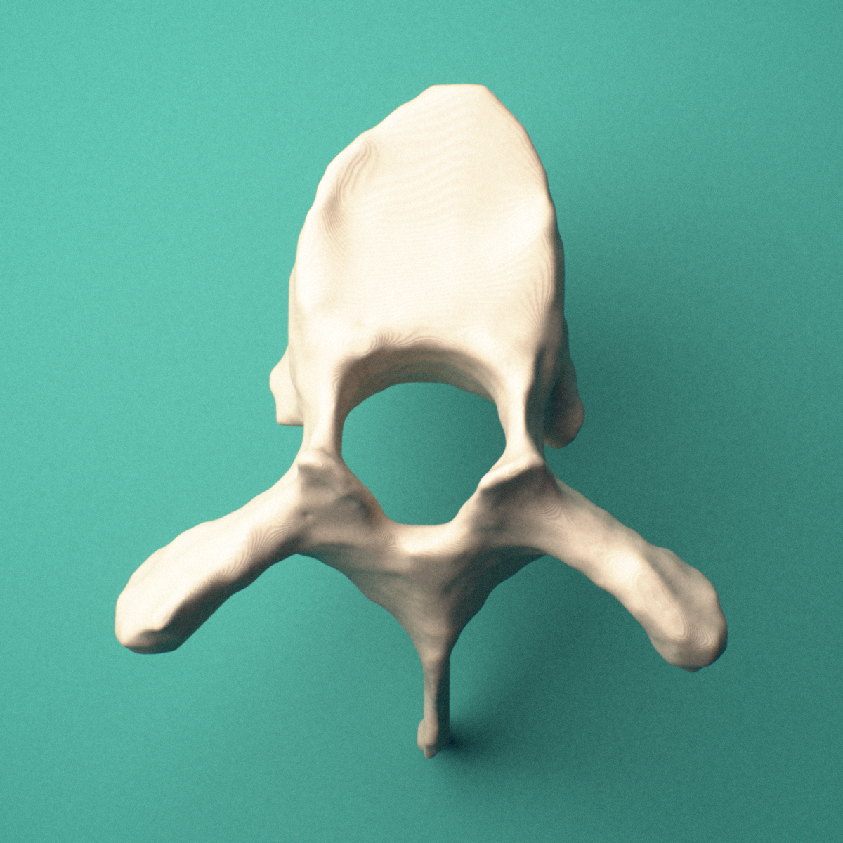 3D-printed T6 thoracic vertebra, superior view showing the vertebral body and vertebral foramen.