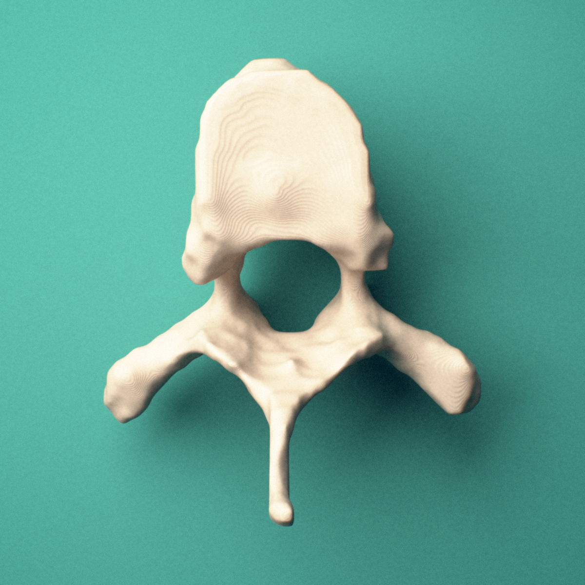 3D-printed T6 thoracic vertebra, superior oblique view showing the spinous process and superior costal facets.