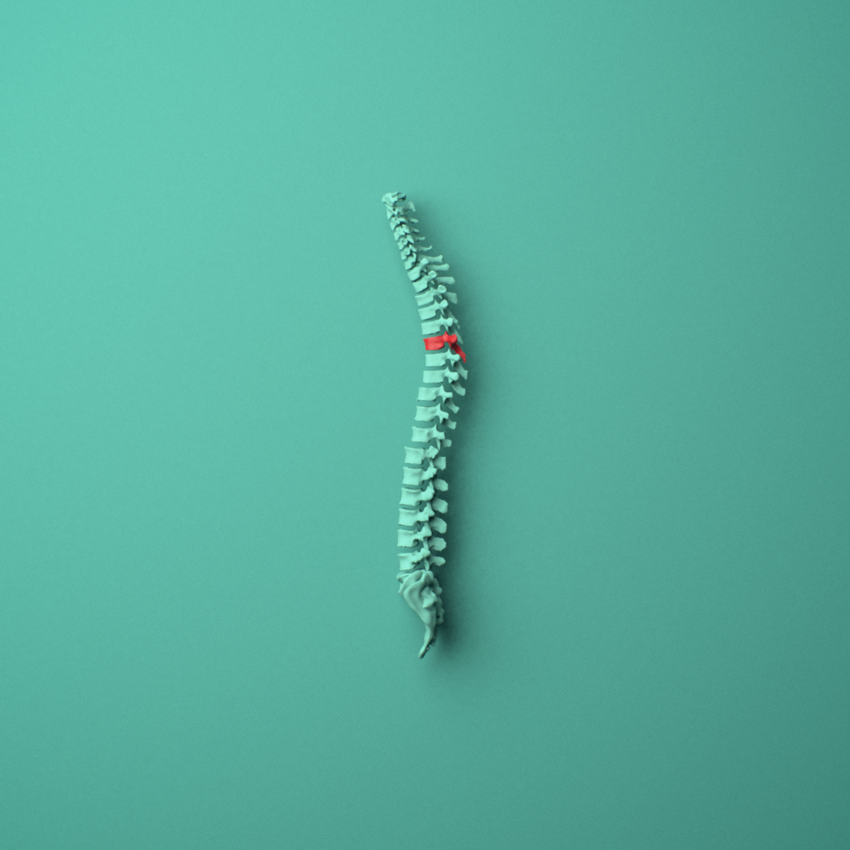3D model of the T6 thoracic vertebra shown in position within a full thoracic spine model, left lateral view.