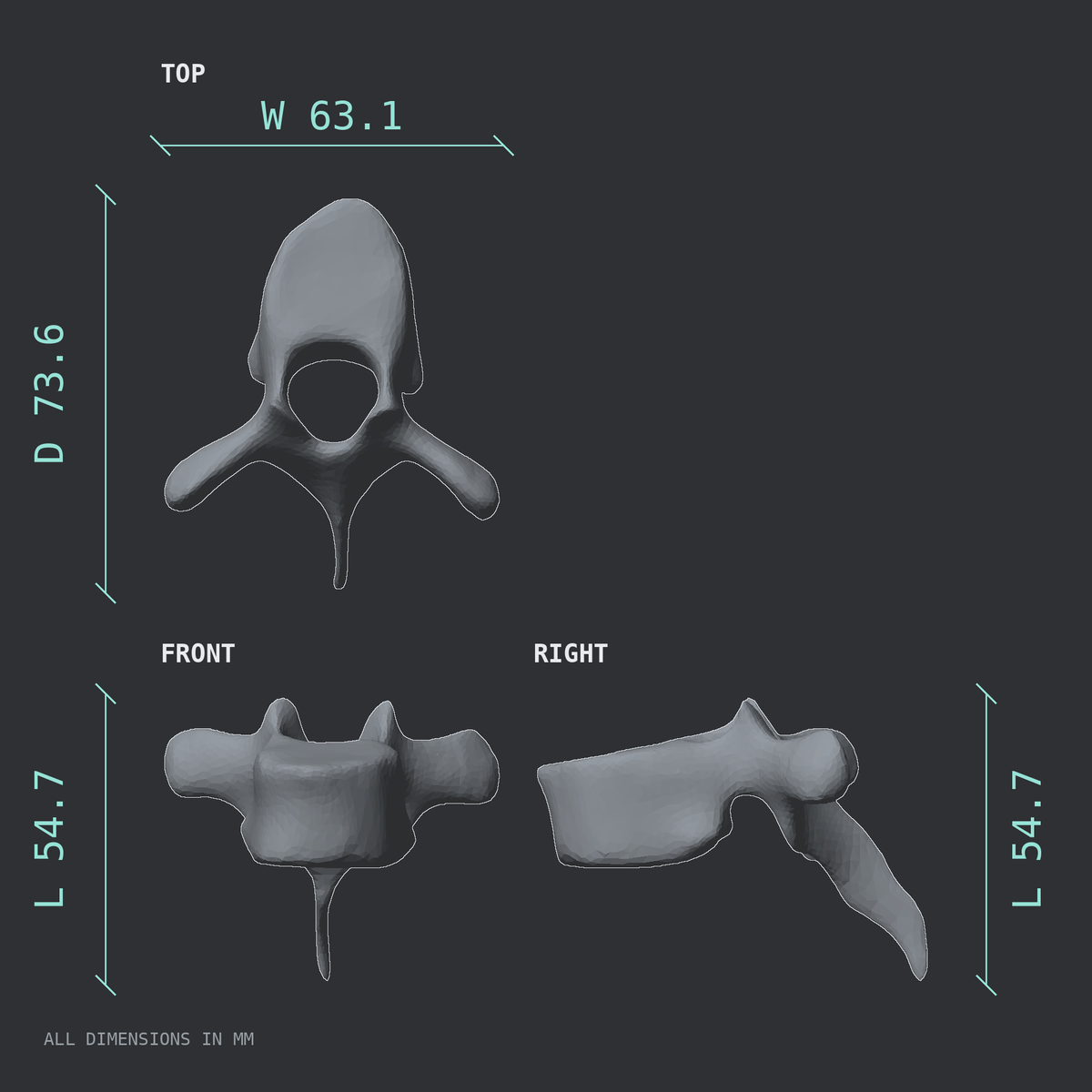3D rendered dimensional drawing of the T6 thoracic vertebra, top, front, and side views.