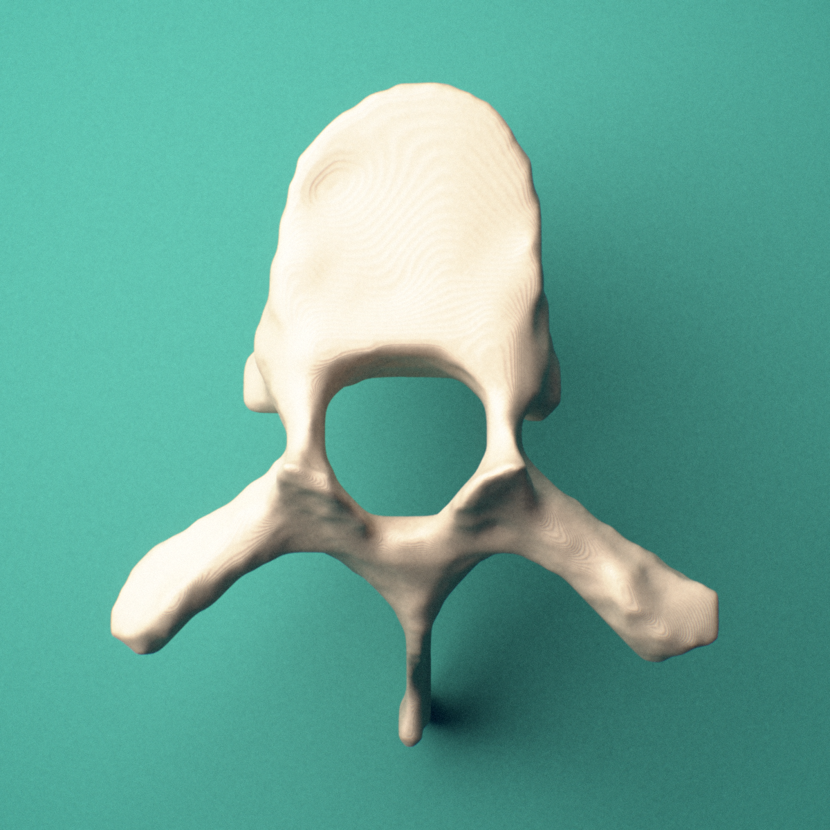 3D-printed T7 thoracic vertebra, superior view showing the vertebral body and vertebral foramen.