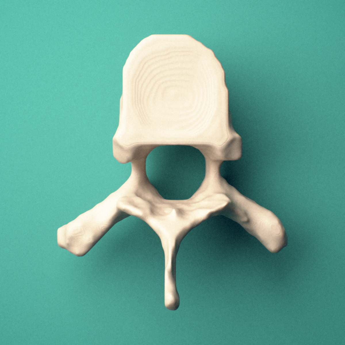 3D-printed T7 thoracic vertebra, superior oblique view showing the spinous process and superior costal facets.