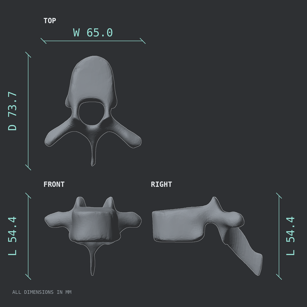 3D rendered dimensional drawing of the T7 thoracic vertebra, top, front, and side views.