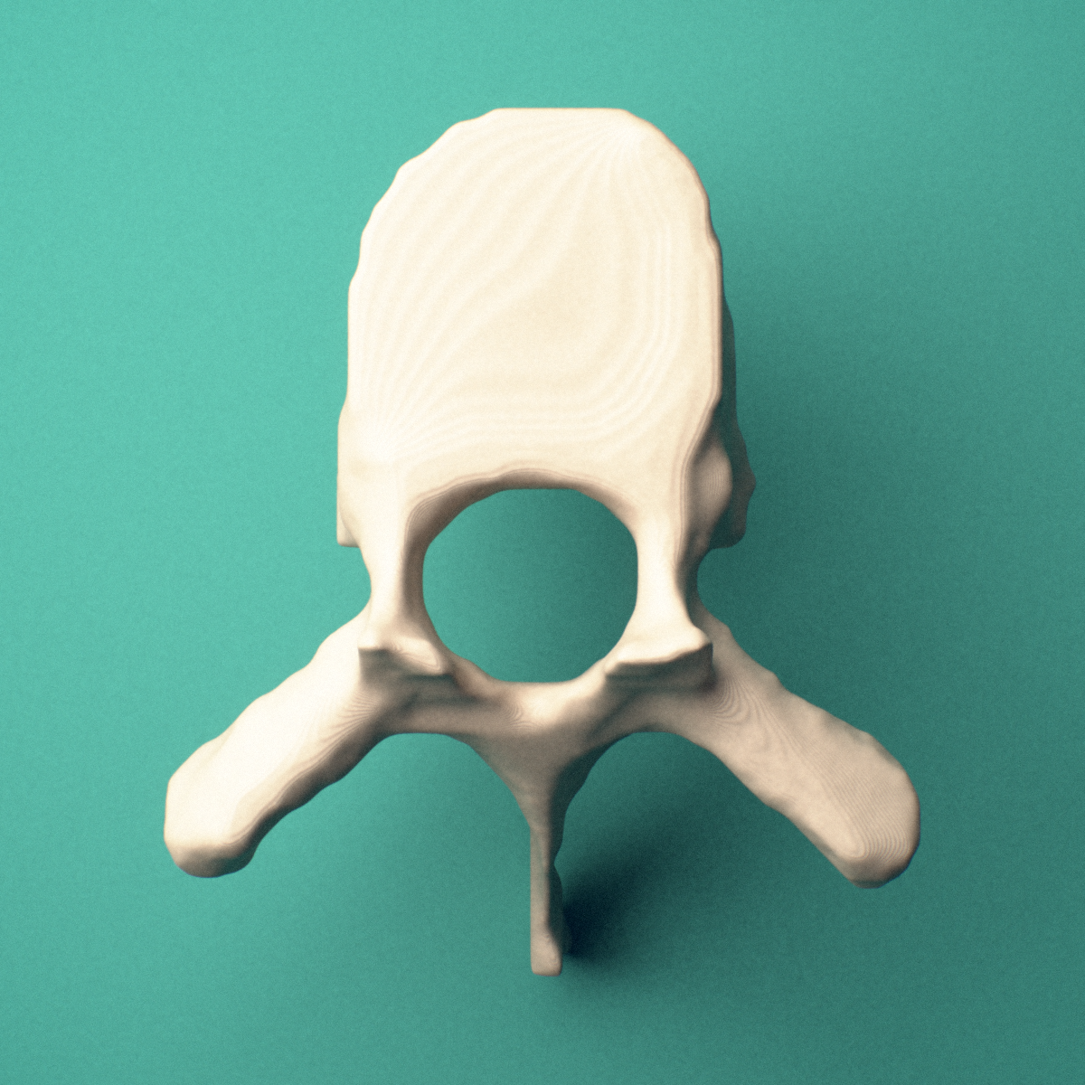 3D-printed T8 thoracic vertebra, superior view showing the vertebral body and vertebral foramen.