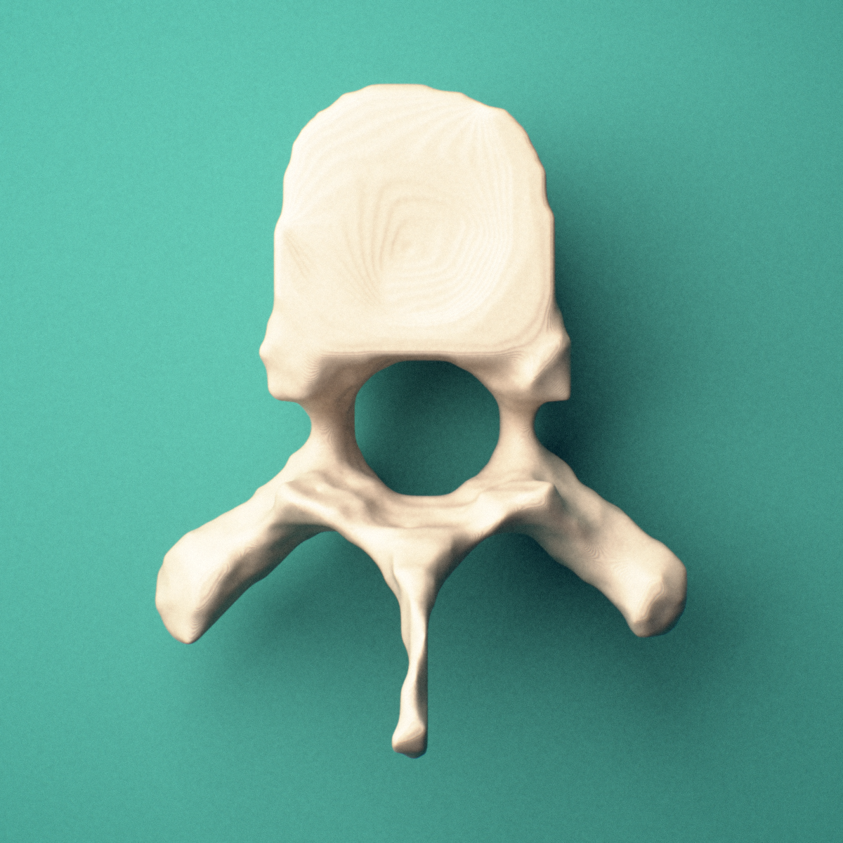 3D-printed T8 thoracic vertebra, superior oblique view showing the spinous process and superior costal facets.