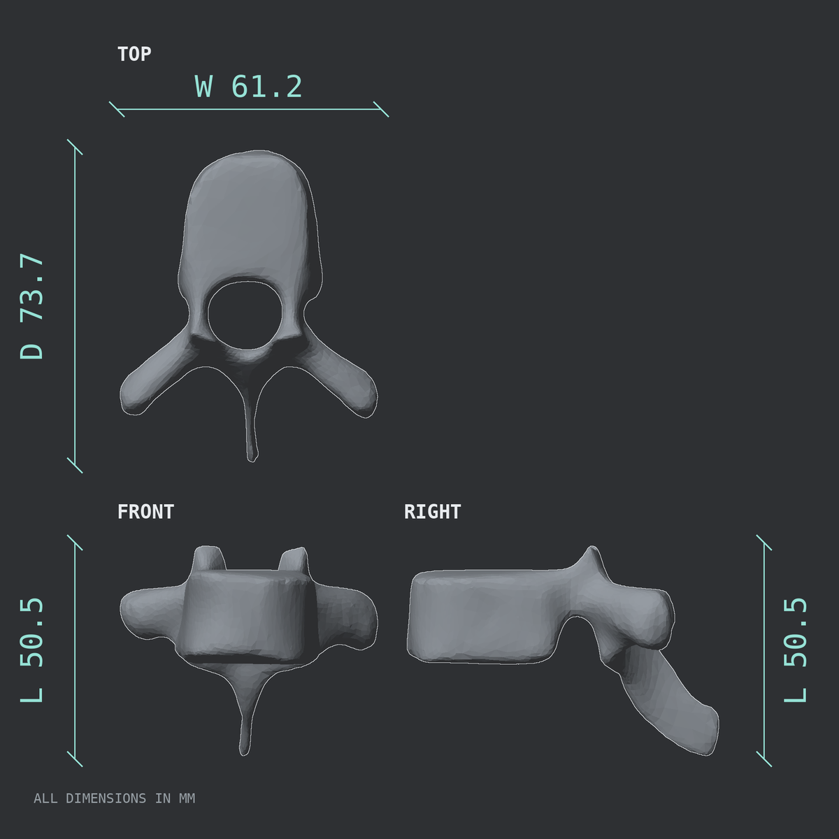 3D rendered dimensional drawing of the T8 thoracic vertebra, top, front, and side views.
