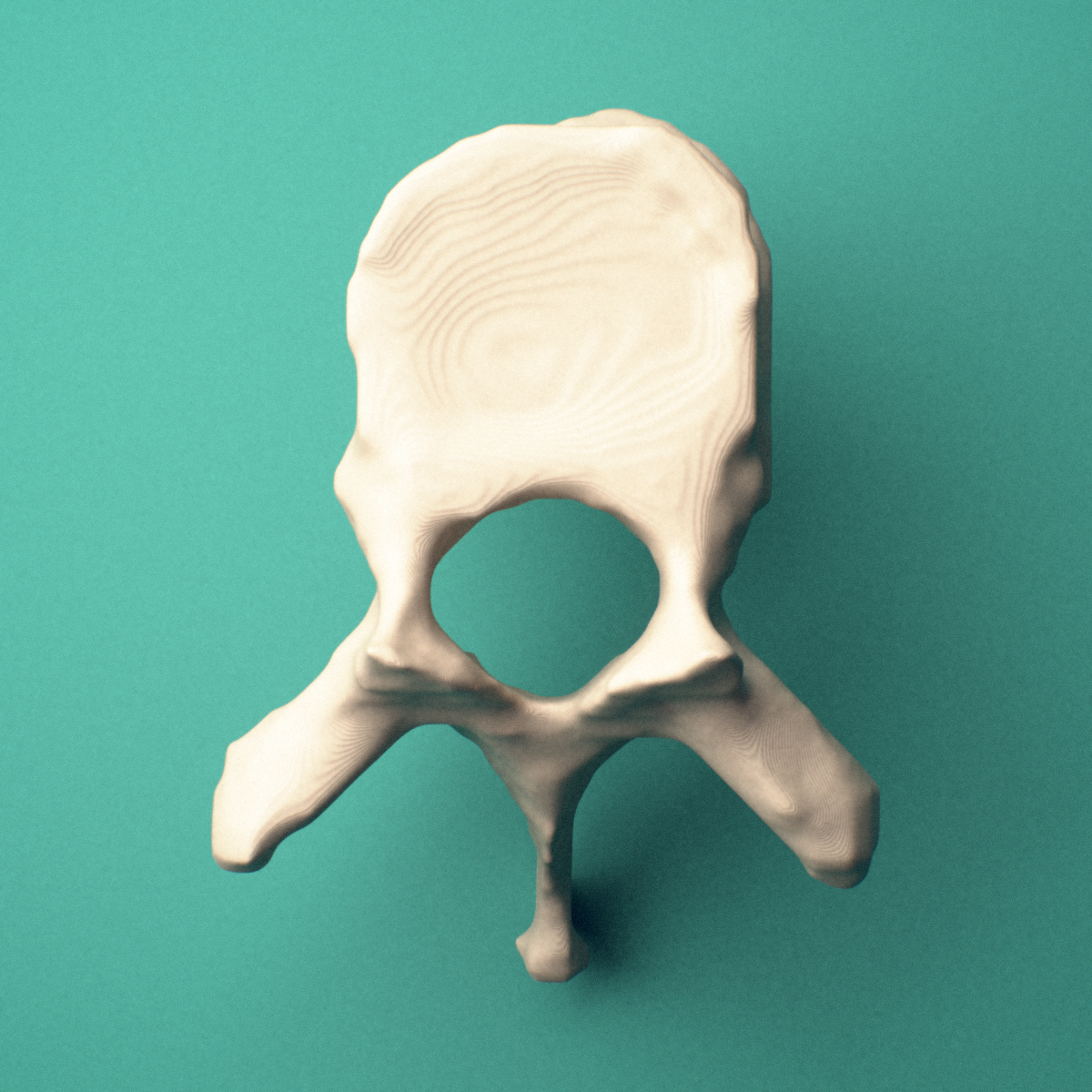 3D-printed T9 thoracic vertebra, superior view showing the vertebral body and vertebral foramen.