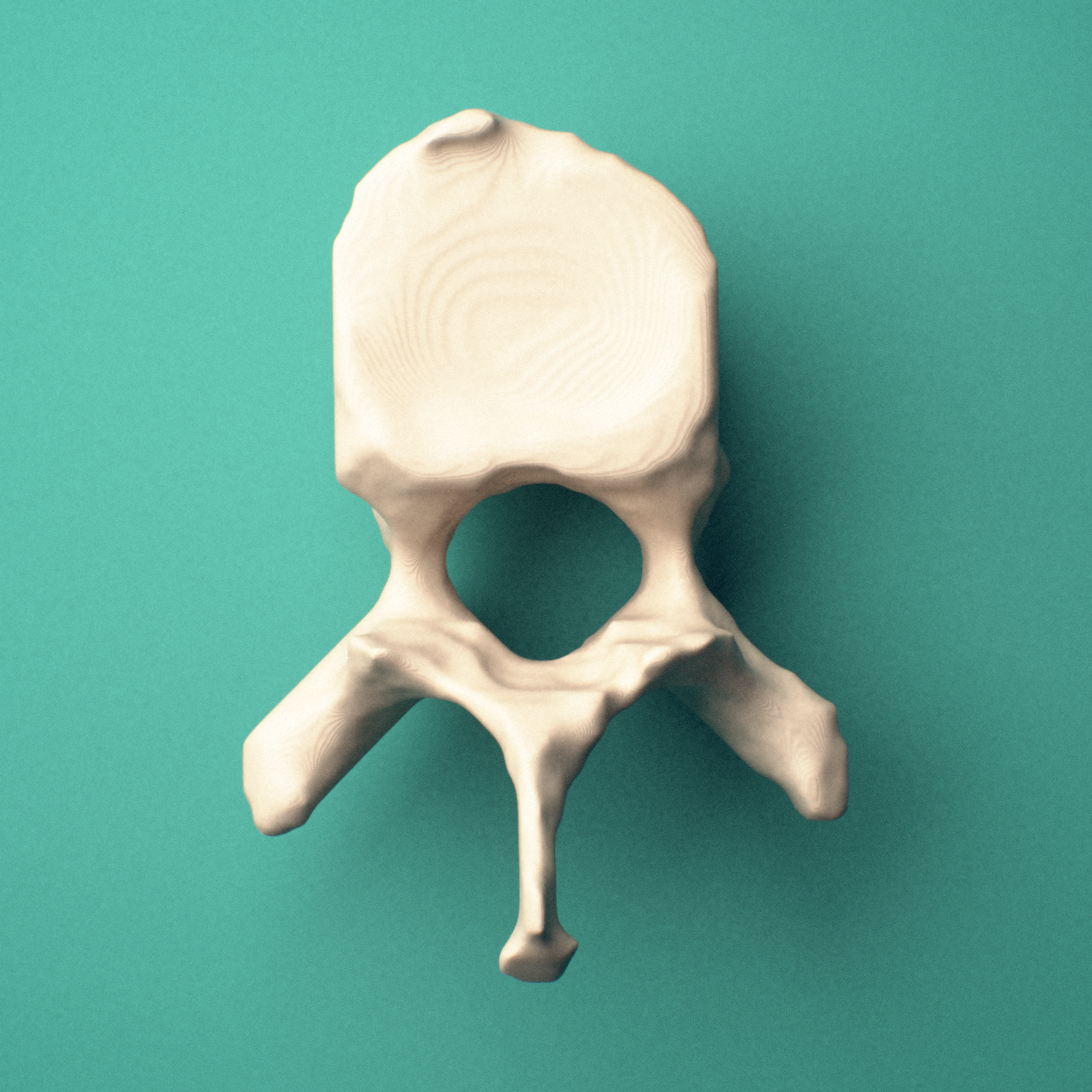 3D-printed T9 thoracic vertebra, superior oblique view showing the spinous process and superior costal facets.