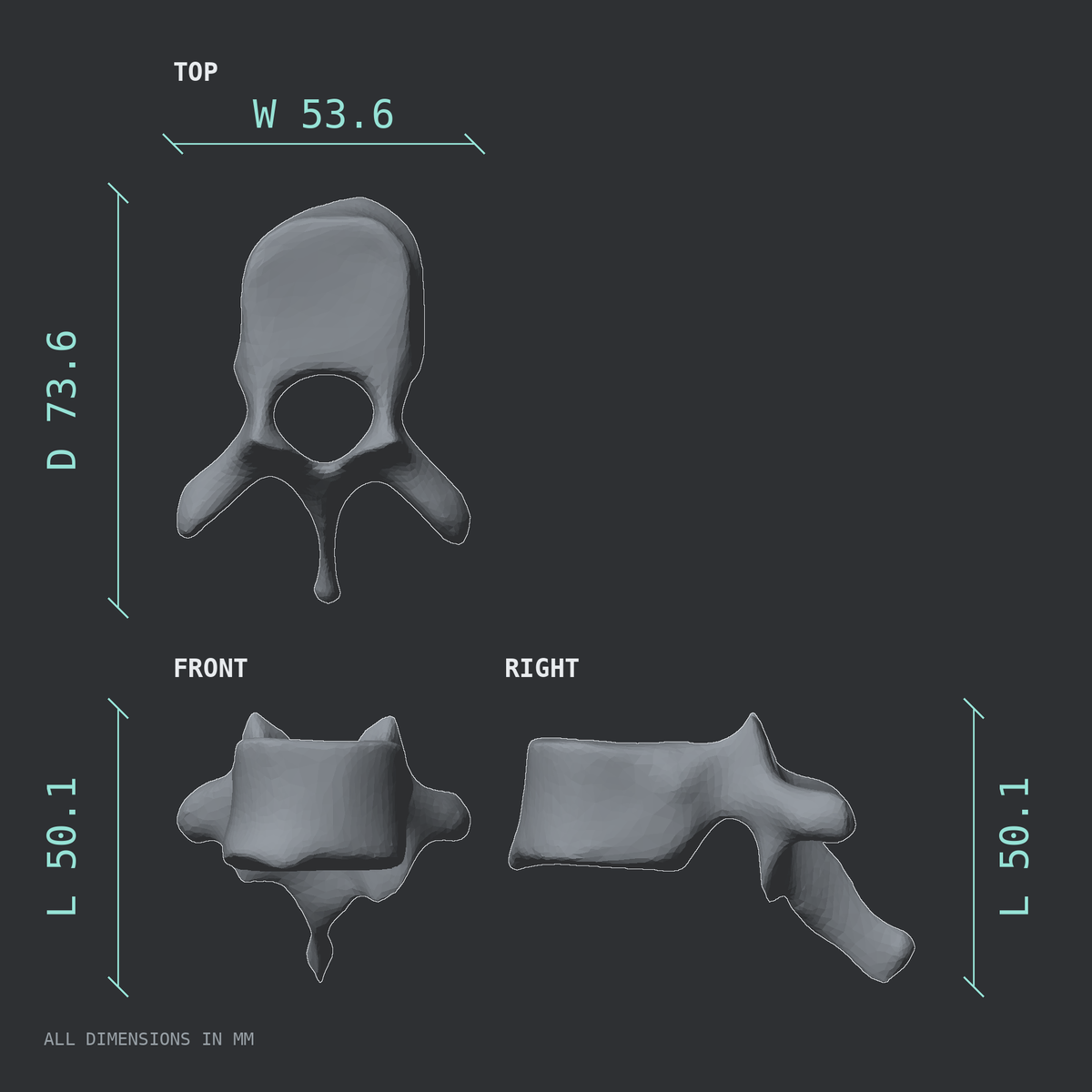 3D rendered dimensional drawing of the T9 thoracic vertebra, top, front, and side views.