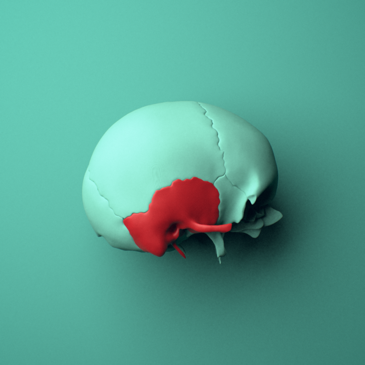 3D model of the Right temporal bone shown in position within a full skull model, right lateral view.