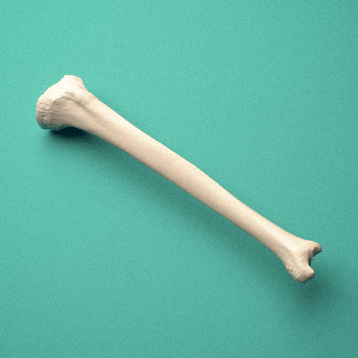 3D-printed Left tibia (shinbone), oblique close-up view showing the medial malleolus.