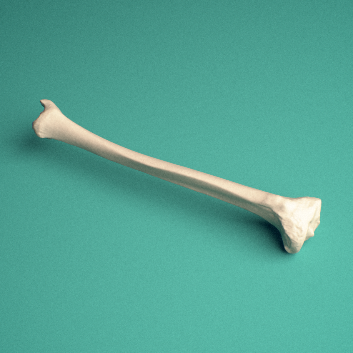 3D-printed Left tibia (shinbone), lateral view showing the shaft and tibial tuberosity and anterior crest.