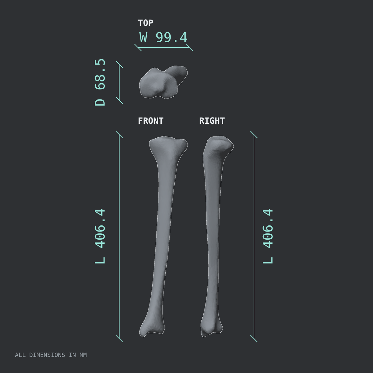 3D rendered dimensional drawing of the Left tibia (shinbone), top, front, and side views.