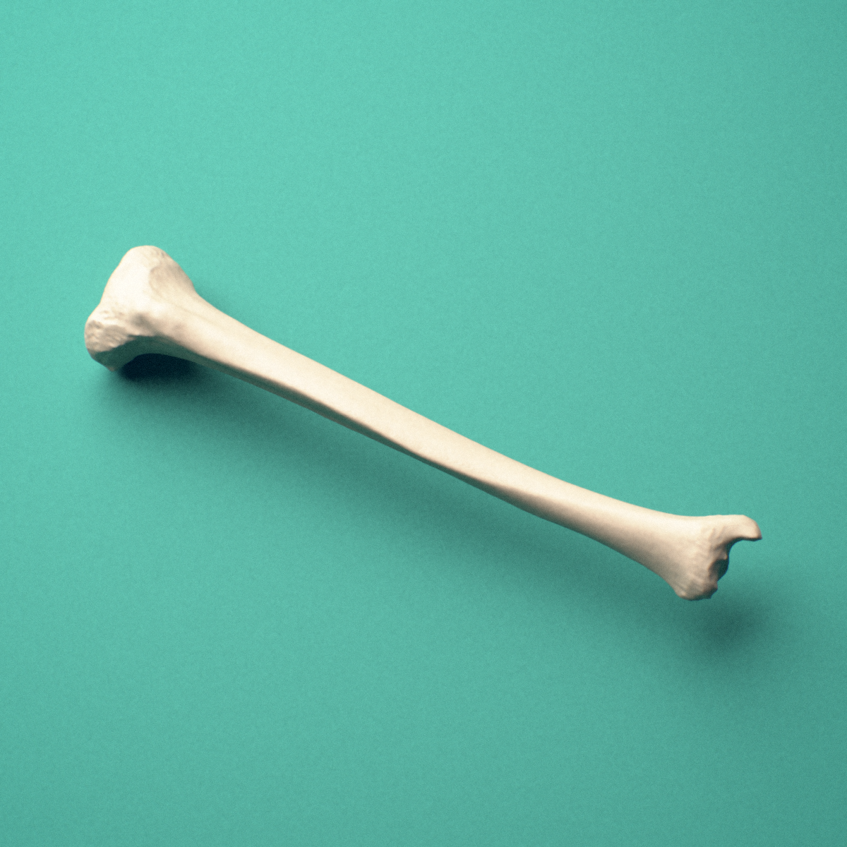 3D-printed Right tibia (shinbone), oblique close-up view showing the medial malleolus.