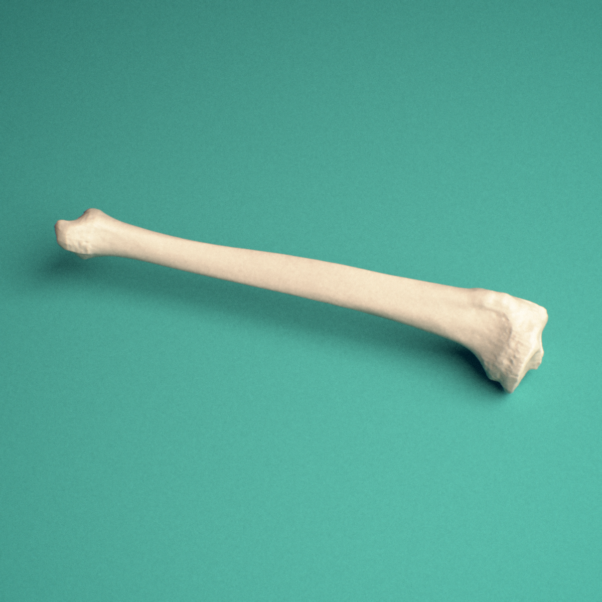 3D-printed Right tibia (shinbone), lateral view showing the shaft and tibial tuberosity and anterior crest.