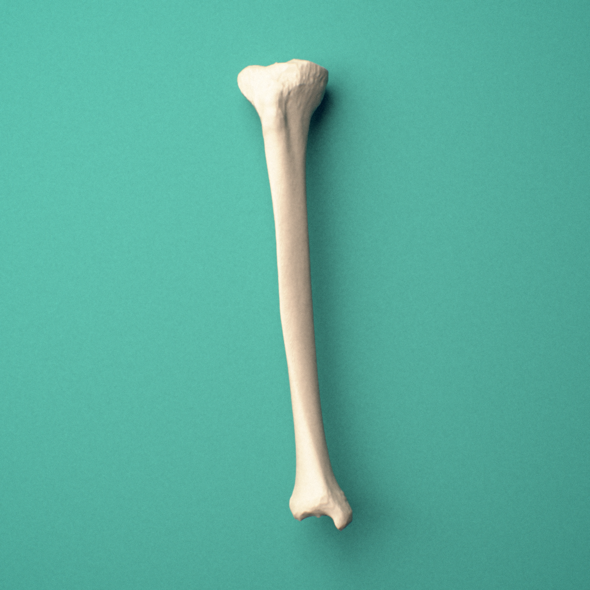 3D-printed Right tibia (shinbone), oblique close-up view showing the medial and lateral condyles from this angle.