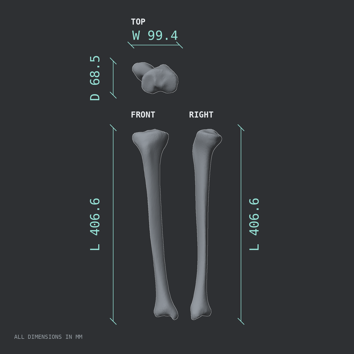 3D rendered dimensional drawing of the Right tibia (shinbone), top, front, and side views.
