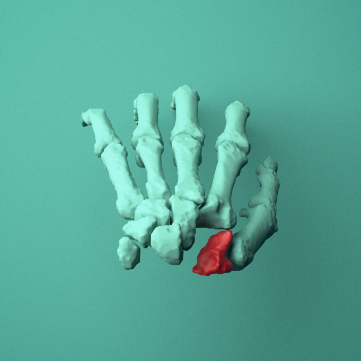 3D model of the Left trapezium bone (wrist) shown in position within a full hand and wrist model, superior view.