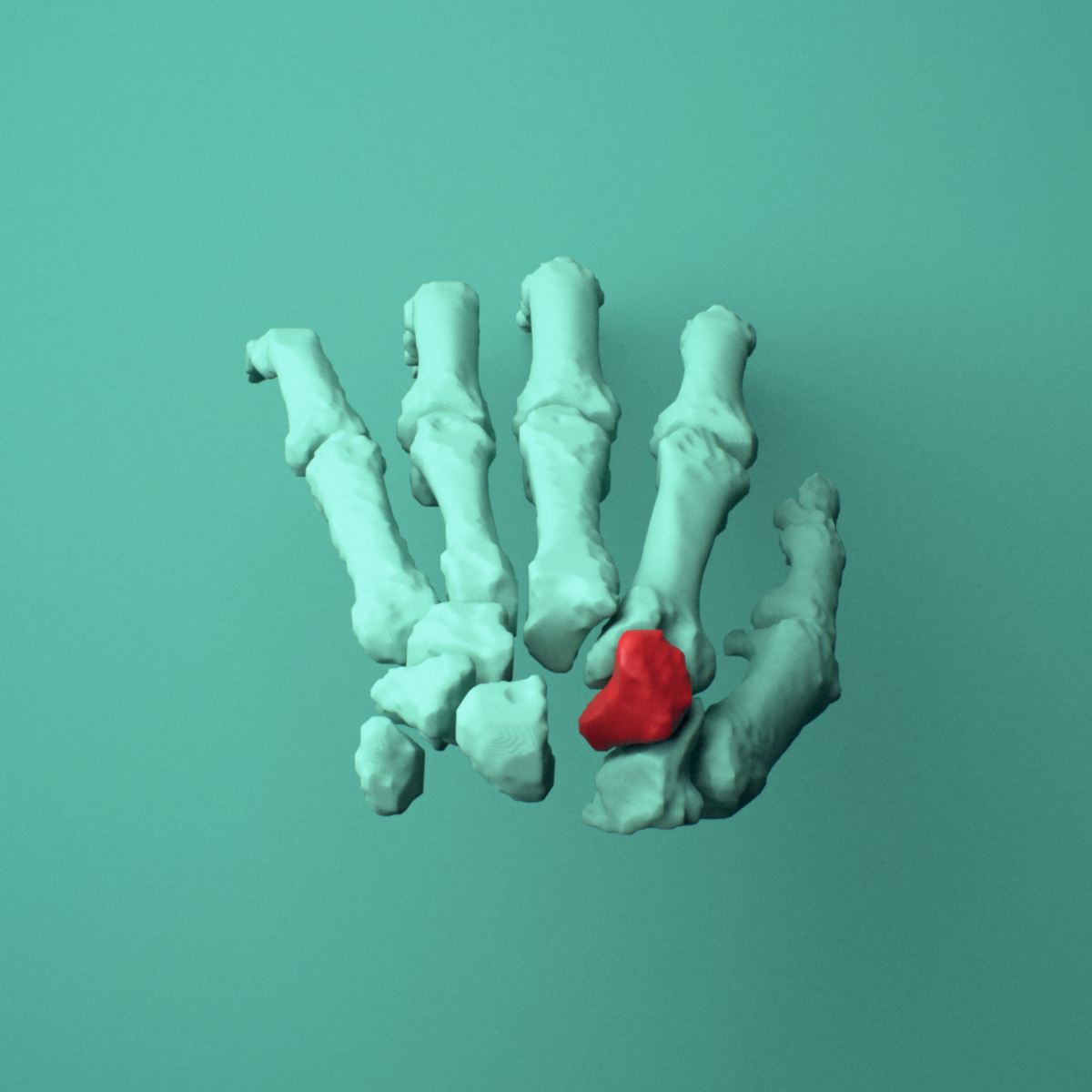 3D model of the Left trapezoid bone (wrist) shown in position within a full hand and wrist model, superior view.