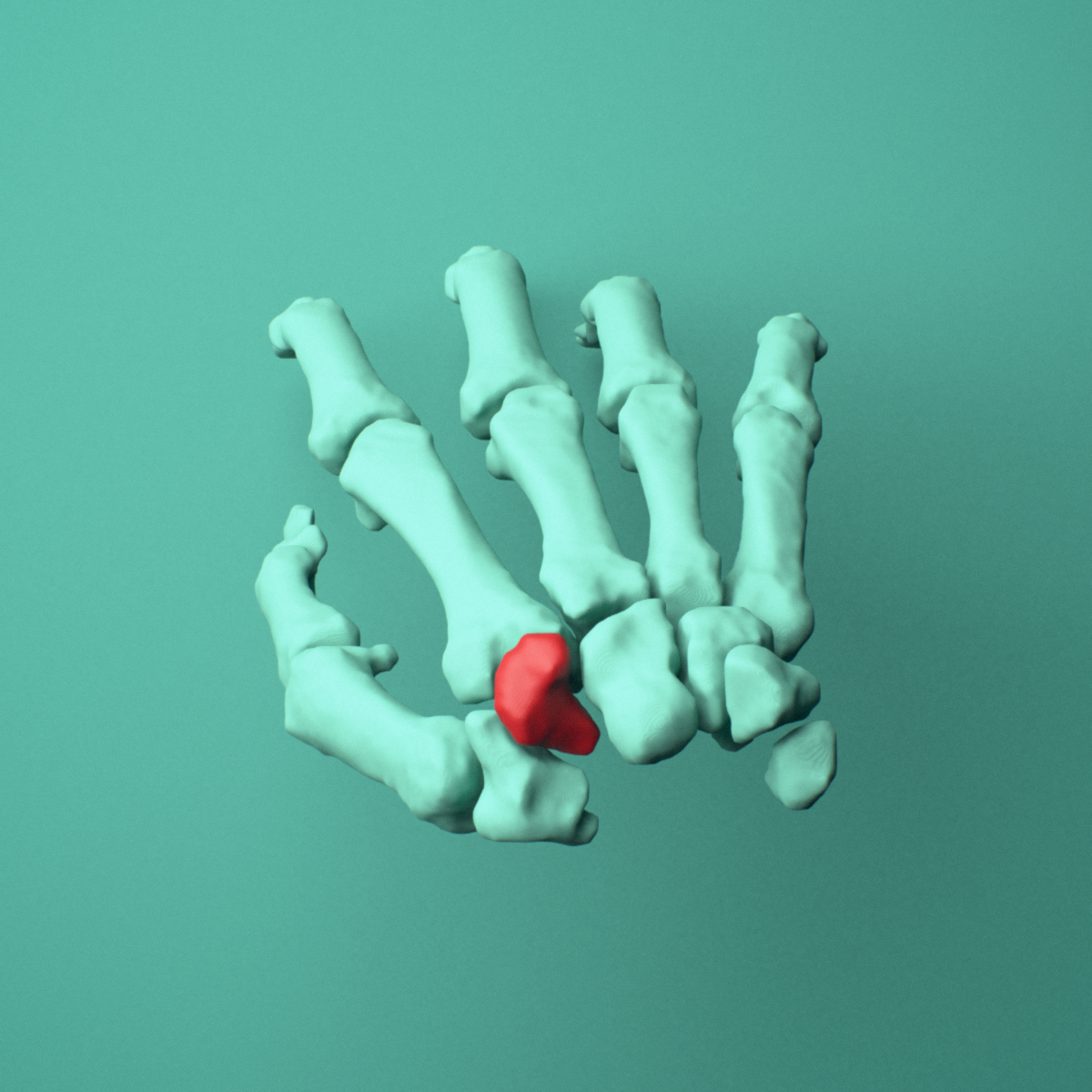 3D model of the Right trapezoid bone (wrist) shown in position within a full hand and wrist model, superior view.