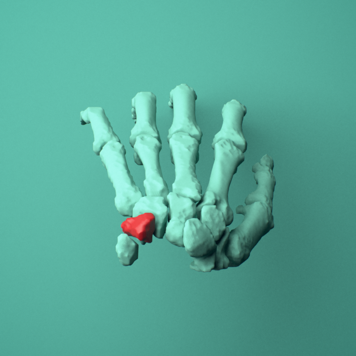 3D model of the Left triquetrum bone (wrist) shown in position within a full hand and wrist model, superior view.