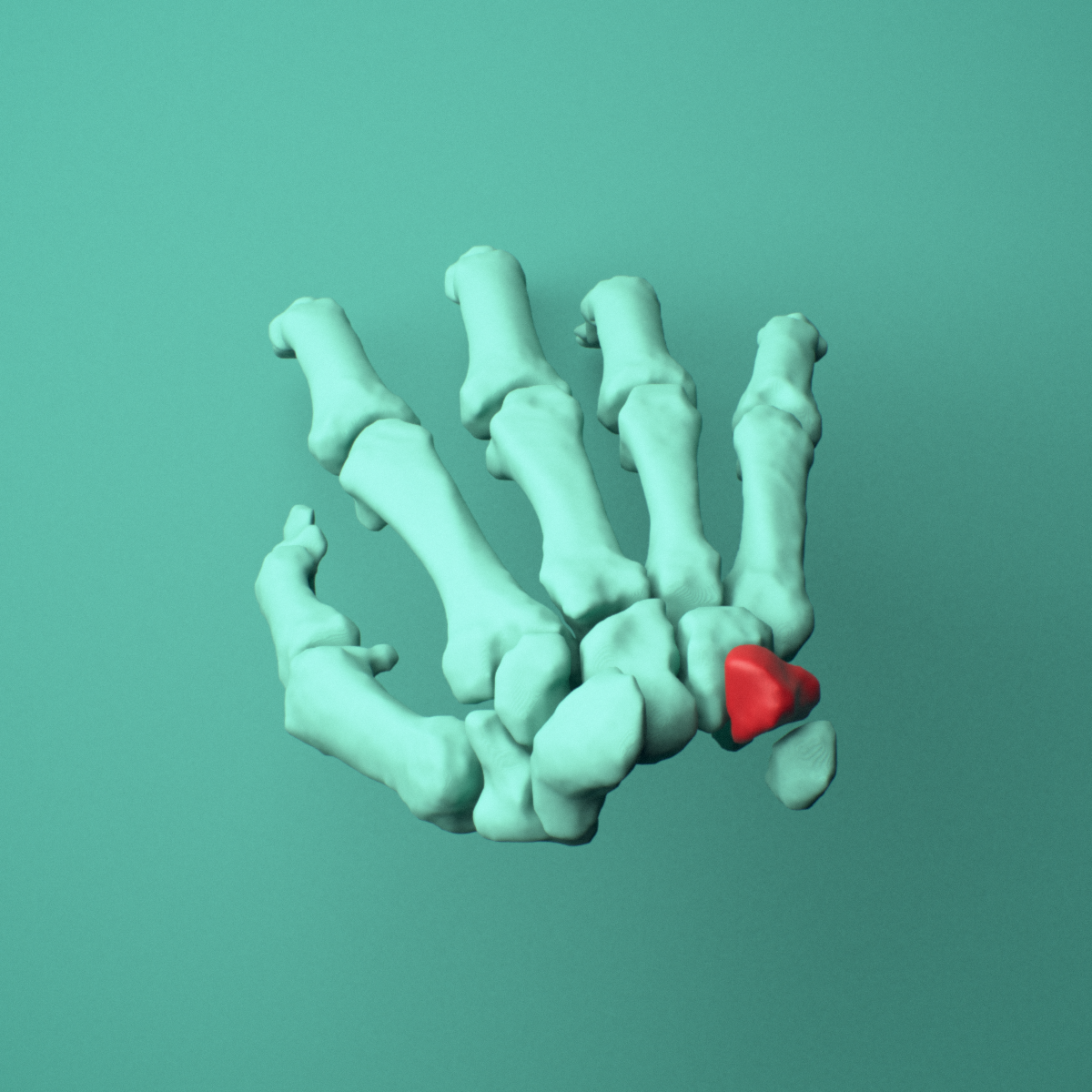 3D model of the Right triquetrum bone (wrist) shown in position within a full hand and wrist model, superior view.