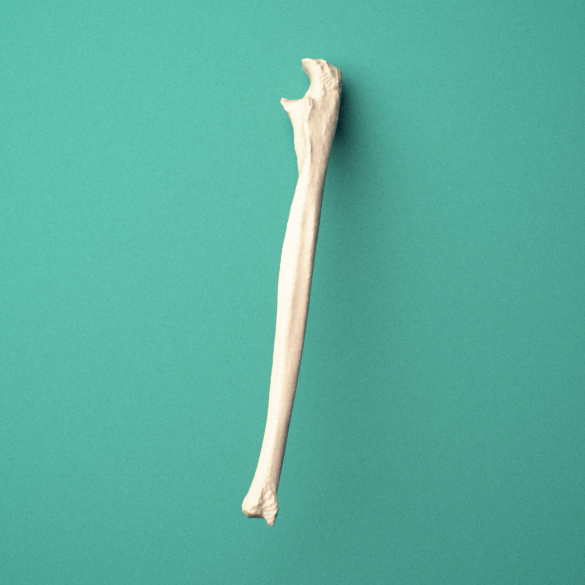 3D-printed Left ulna, oblique close-up view showing the olecranon and coronoid process from this angle.