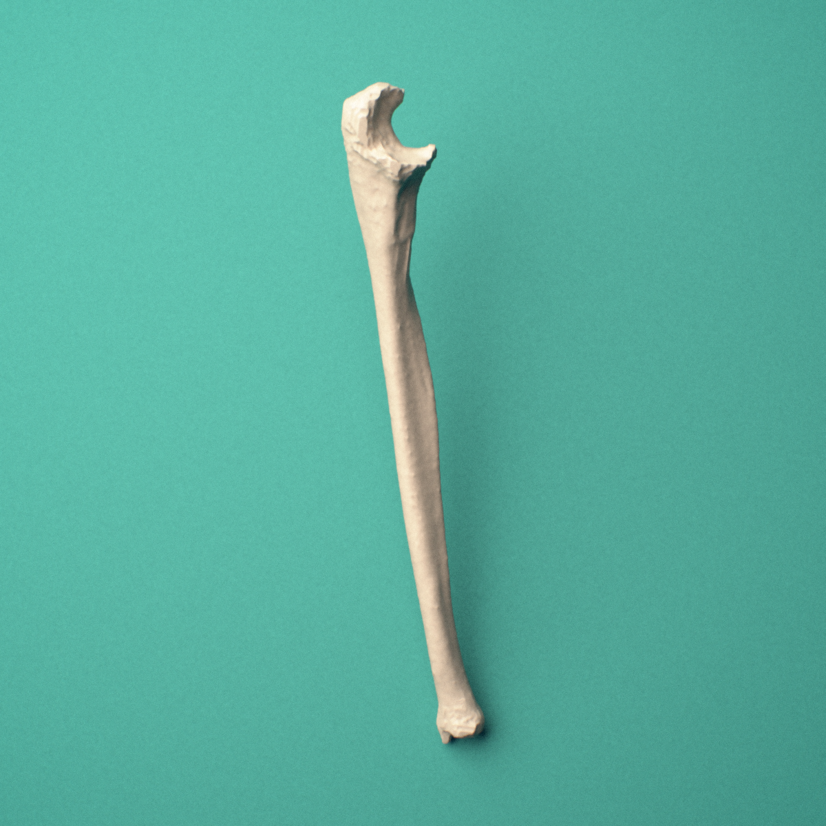 3D-printed Left ulna, oblique close-up view showing the head and styloid process from this angle.