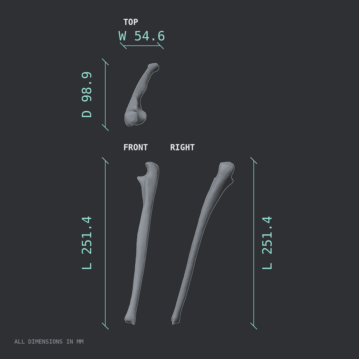 3D rendered dimensional drawing of the Left ulna, top, front, and side views.
