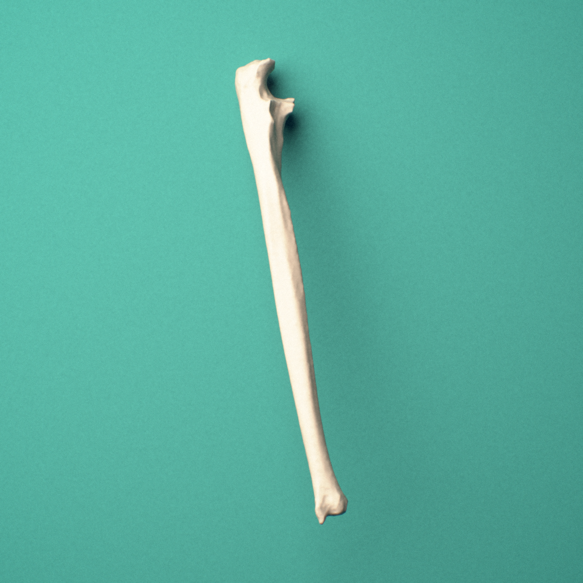 3D-printed Right ulna, oblique close-up view showing the olecranon and coronoid process from this angle.