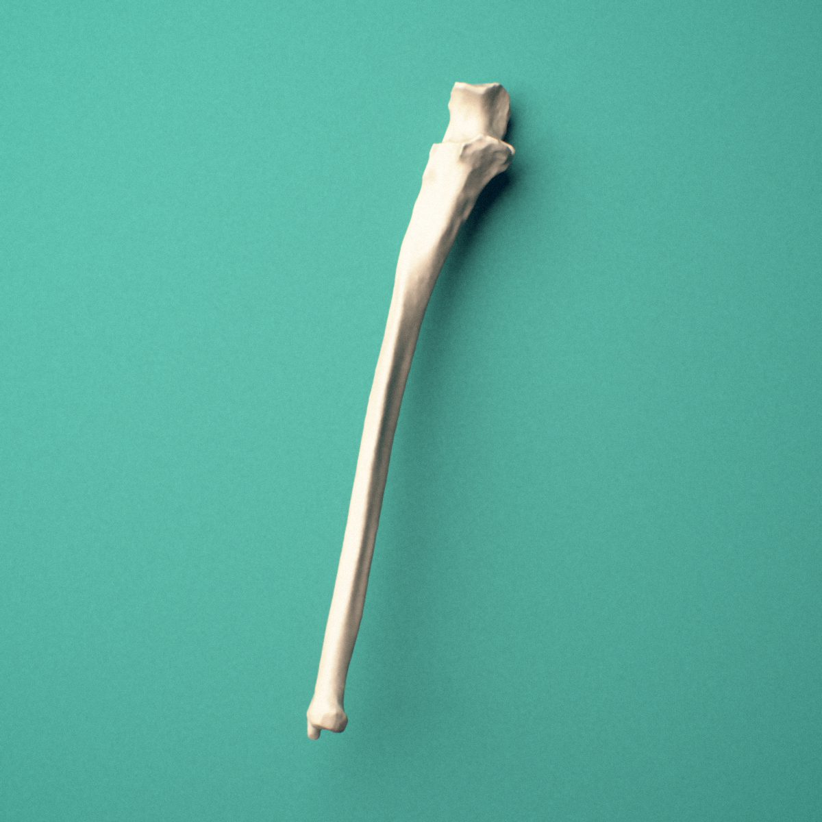 3D-printed Right ulna, medial view showing the shaft and trochlear notch.