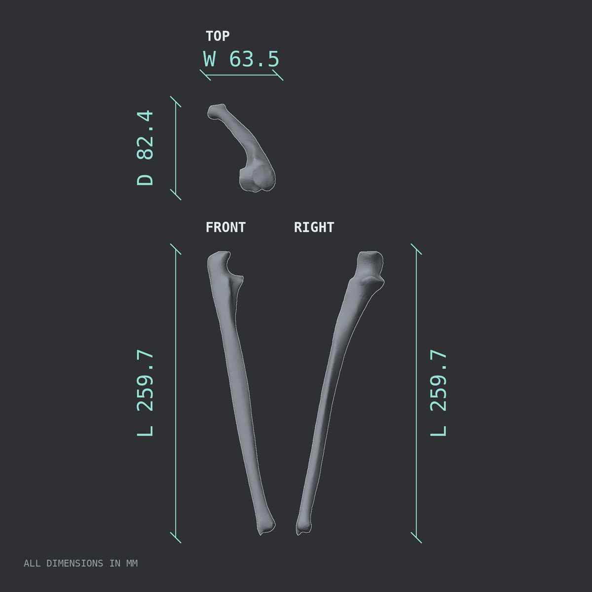 3D rendered dimensional drawing of the Right ulna, top, front, and side views.