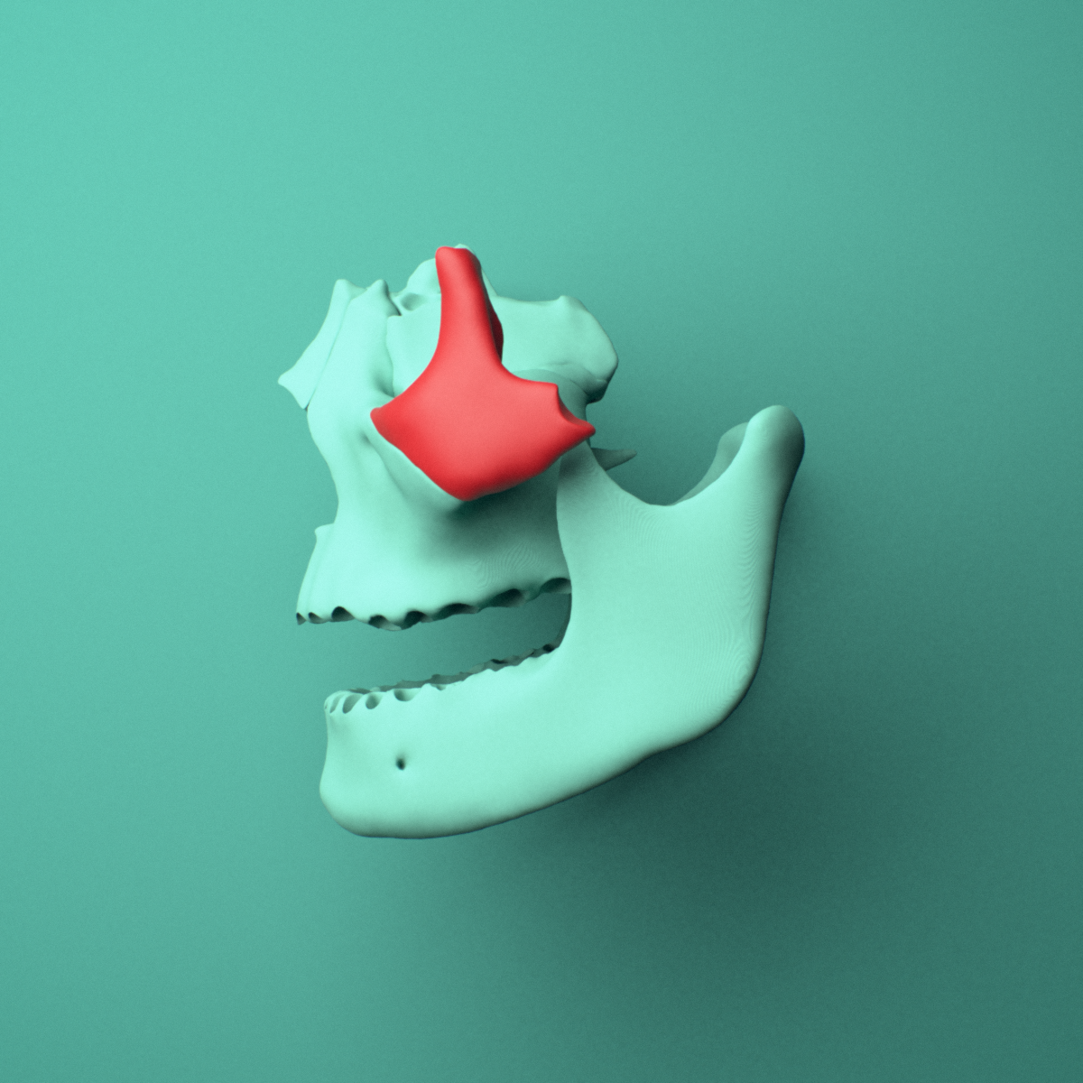 3D model of the Left zygomatic bone (cheekbone) shown in position within a full skull model, left lateral view.