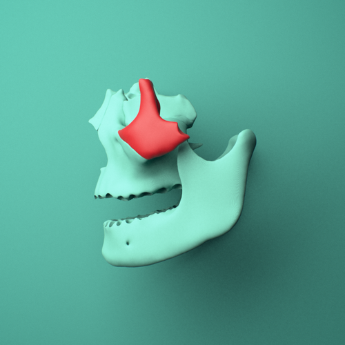 3D model of the Left zygomatic bone (cheekbone) shown in position within a full skull model, left lateral view.