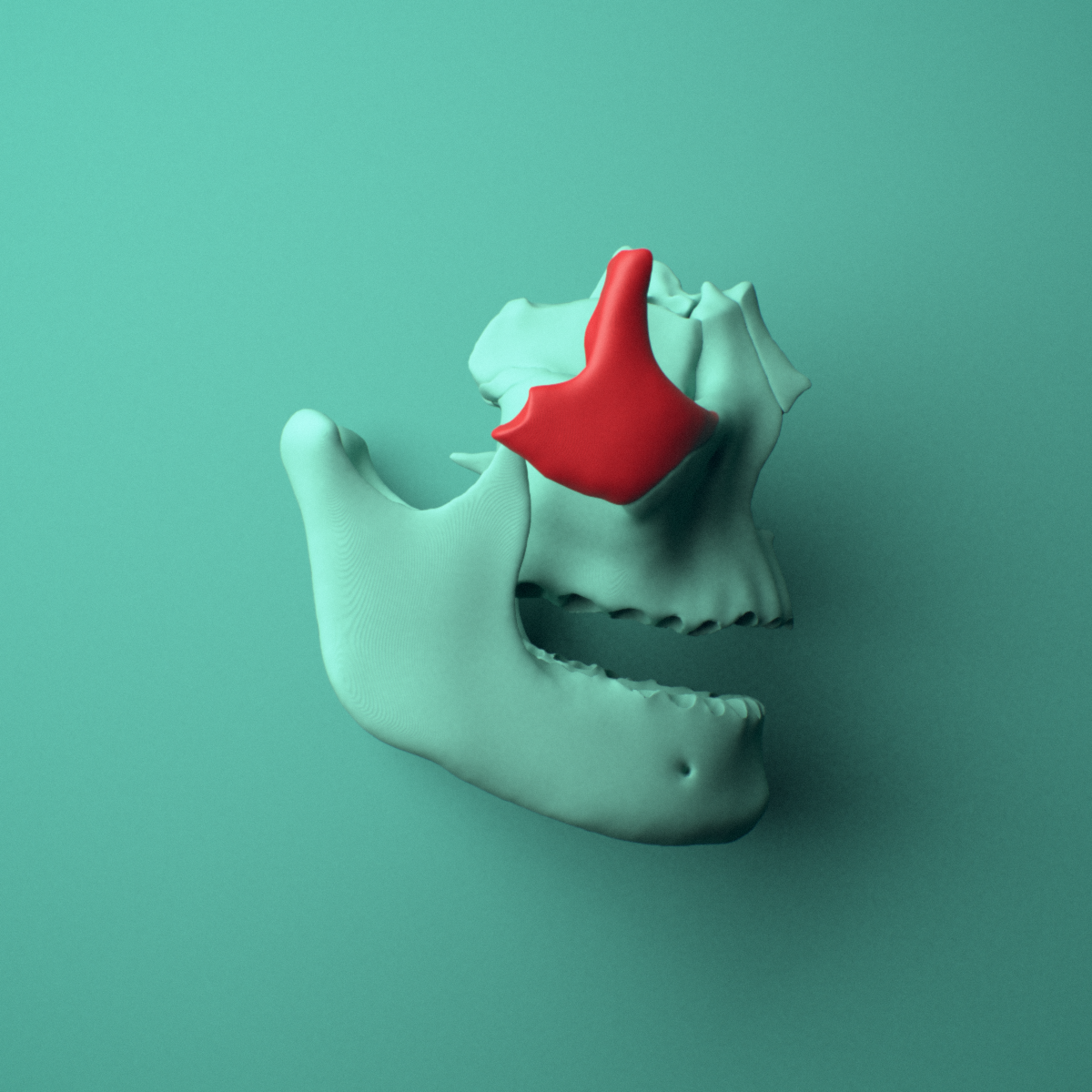 3D model of the Right zygomatic bone (cheekbone) shown in position within a full skull model, right lateral view.